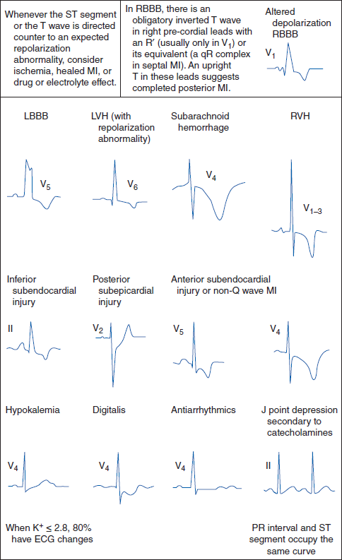 Basic Electrocardiography Guide To Diagnostic Tests