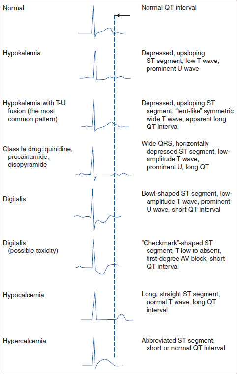 BASIC ELECTROCARDIOGRAPHY | Guide to Diagnostic Tests