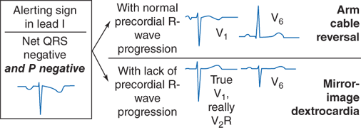 Basic Electrocardiography Guide To Diagnostic Tests