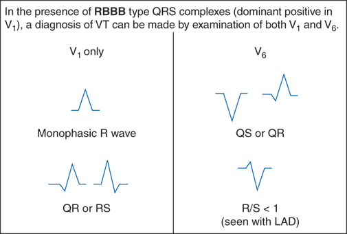 Basic Electrocardiography Guide To Diagnostic Tests